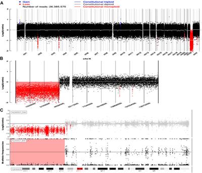 Case Report: From epilepsy and uterus didelphys to Turner syndrome-associated dysgerminoma